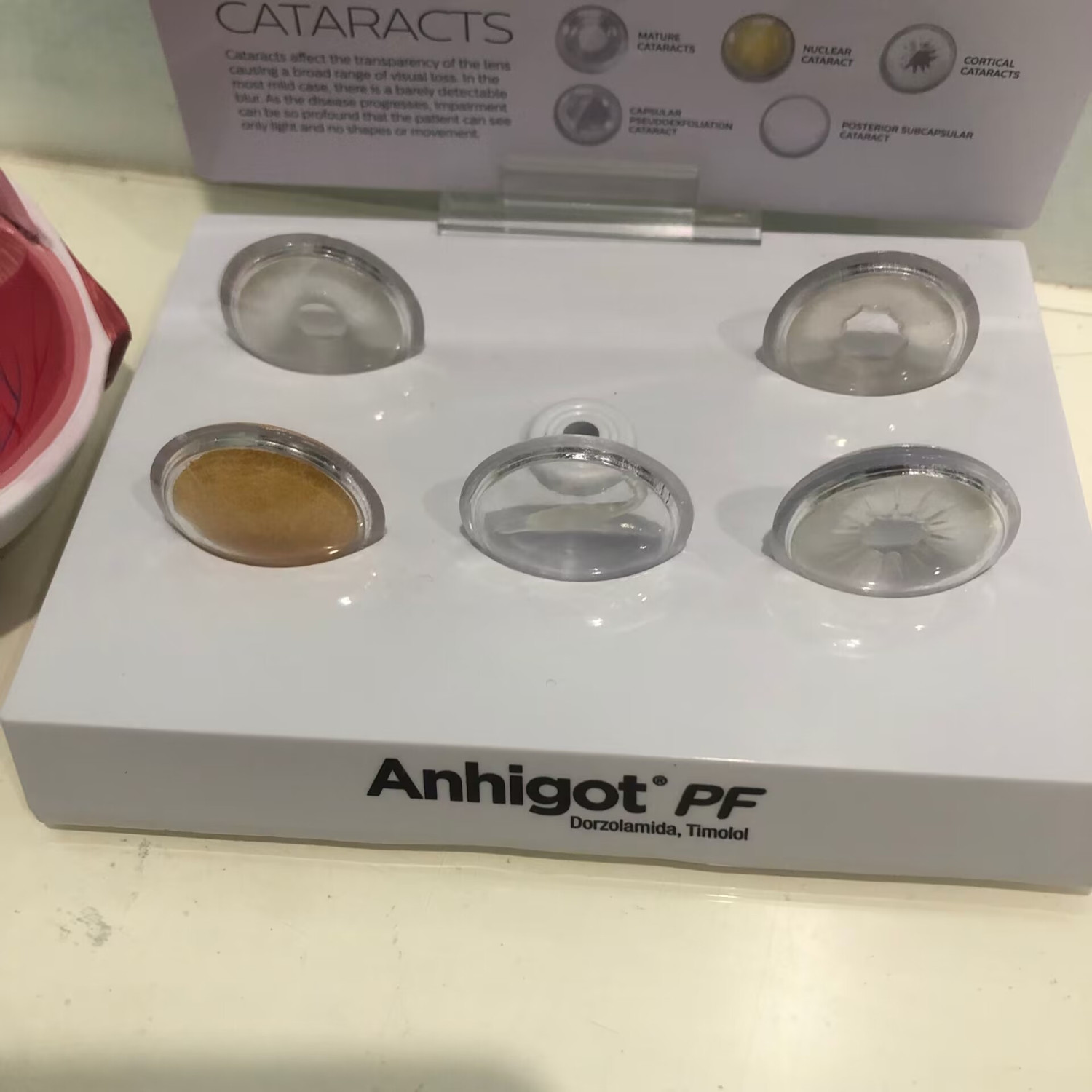 眼模型 白内障眼模型、教育実験医学解剖模型 眼科クリニック展 - Science Exhibition Models のレビューと価格